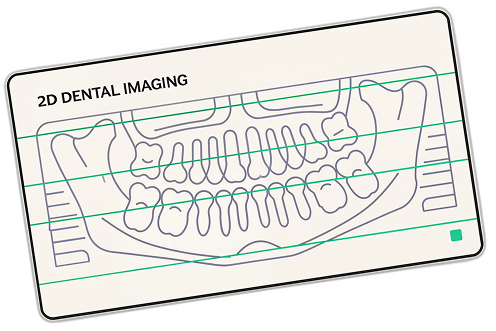 2d snimanje zuba vizual